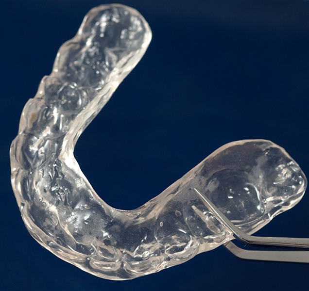 Night Guard Appliances Sleep Apnea | Harmony Family Dental Care | Springbank General and Family Dentist