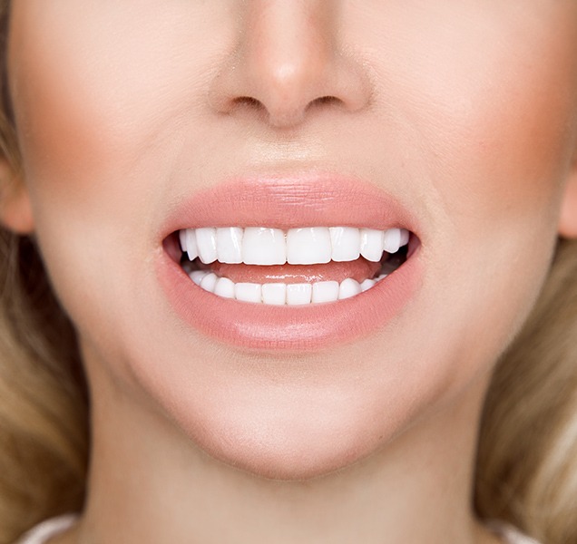 Porcelain Veneers | Harmony Family Dental Care | Springbank General and Family Dentist