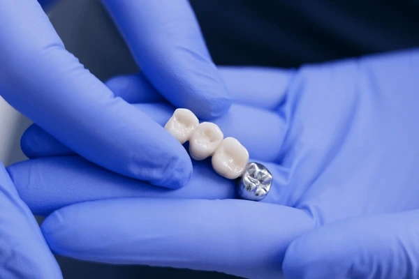 dental bridges near you