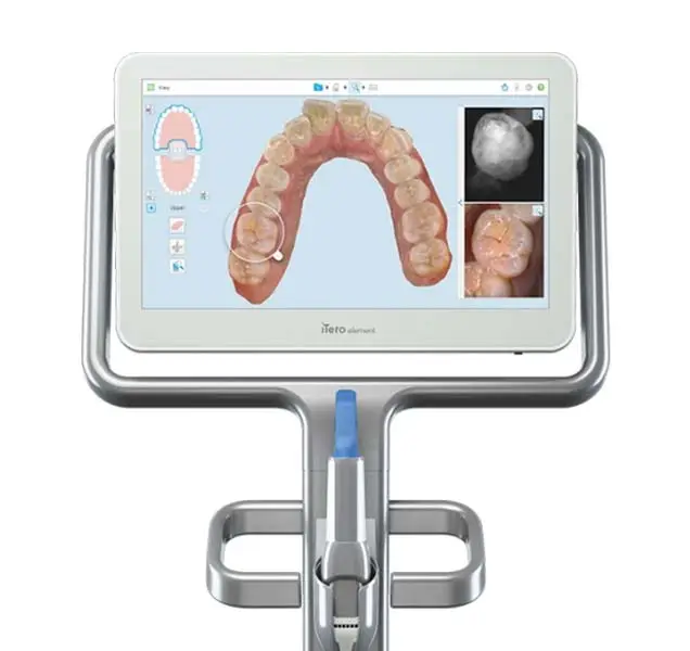 itero wellness scanner display