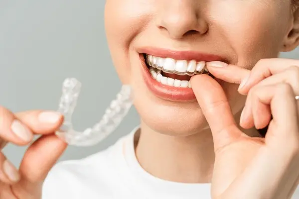 orthodontics in harmony ab