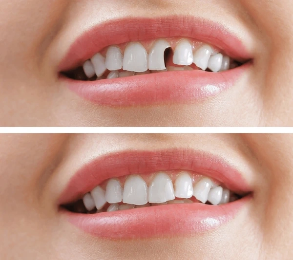 restorative dentistry near you