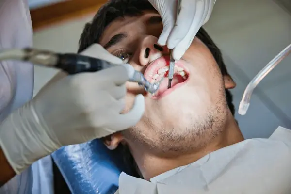 root canal therapy near you