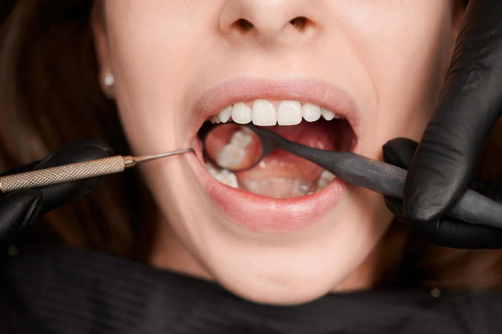 tooth extraction in harmony, ab